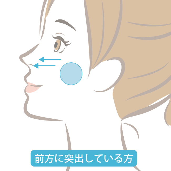 前方に突出している方